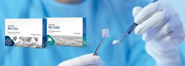 Bone Augmentation & Sinus Lift - Korona Dental Belgrade