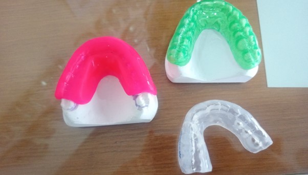 Bruxism Night Guards (Splints) - Korona Dental Belgrade